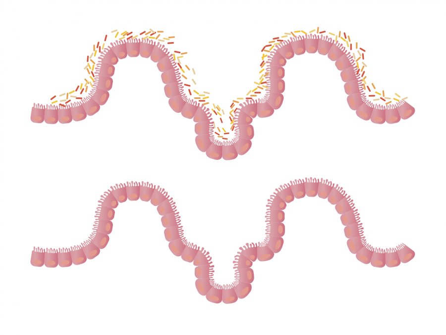 sindrom propusnih crijeva leaky gut prirodno liječenje - prirodni lijekovi za hiperpermeabilnost